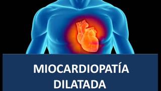 Miocardiopatía dilatada  Fisiopatología [upl. by Reggis]