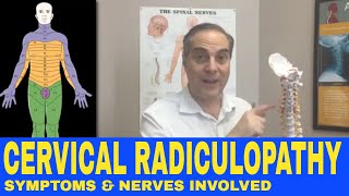 Cervical Radiculopathy Symptoms Nerve Chart Nerve Distribution  Dr Walter Salubro [upl. by Eibrab]