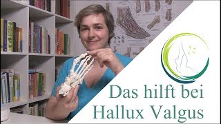 Das hilft bei Hallux Valgus podologinandrea [upl. by Papp15]