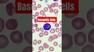 Basophils Cells  Blood smear slide microscopy Basophils bloodtest dmltlab viral trrndings [upl. by Notlim285]