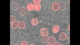 Babesia bovis merozoite egress from a red blood cell [upl. by Erbe]