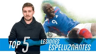 Las 5 Peores lesiones de la historia del fútbol [upl. by Ahsikcin]