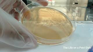 Oxidase Test for Pseudomonas [upl. by Hennebery522]