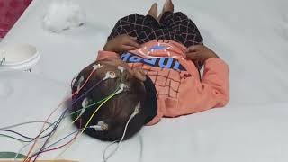 16 CHANNEL EEG TEST CHILD  how to do EEG  EEG tutorial tutorial electroencephalography [upl. by Tarryn]