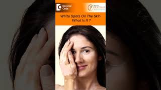 5 Common Causes of White Spots on skin in Children amp Adults DrNydile S V Doctors Circle shorts [upl. by Eatnhoj]