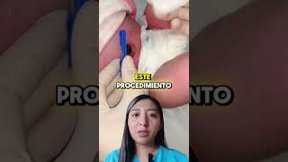 ⚠¡NO MAS COMPLICACIONES NEONATALES 👶 [upl. by Bengt21]