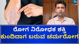 SORIASIS SKIN PROBLEM  GOOD LIFE  ಚಳಿಗಾದಲ್ಲಿ ಹೆಚ್ಚಾಗುತ್ತೆ ಸೋರಿಯಾಸಿಸ್‌ ಚರ್ಮ ಸಮಸ್ಯೆ [upl. by Seaman125]