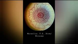 Pteridophyta  Marsilea Permanent Slides of StemRhizome and Sporocarp [upl. by Erdnaed]