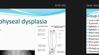 skeletal dysplasia 1 [upl. by Elephus59]