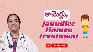 కామెర్లు jaundiceHomeo treatment SudharamanHomeoClinic [upl. by Nanice]