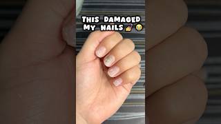 Nail extensions ki galti 😭😭nails nailsextension viralvideo shortsfeed viralshort trending [upl. by Aubreir]