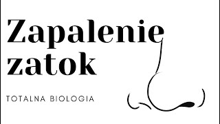 Zapalenie zatok Przyczyny problemów z zatokami Leczenie zatok Totalna Biologia [upl. by Dnomhcir]