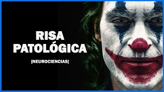 El trastorno que hace reír al Joker  afecto pseudobulbar [upl. by Nivad]