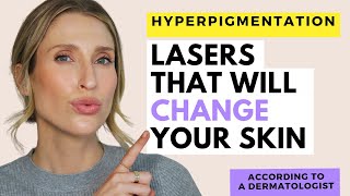 The Best Laser Treatments for Hyperpigmentation  Dr Sam Ellis [upl. by Arahs918]