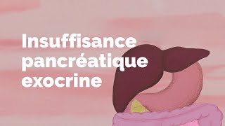 Insuffisance pancréatique exocrine  Société gastrointestinale [upl. by Willin]