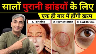 Pigmentation amp Dark Spots का 100 इलाज Treatment Naturally I DR MANOJ DAS drmanojdas [upl. by Nihs]