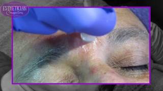 Mens Facial with Clinicians Complex Peptides amp Rezenerate [upl. by Leahsim]