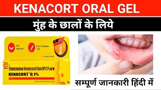 मुंह के छालों का इलाज  kenacort 01 gel  triamcinolone acetonide oromucosal gel  mouth ulcer [upl. by Led]