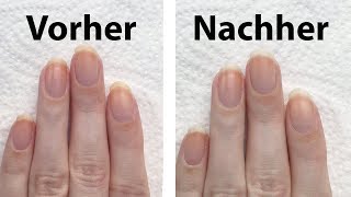 3 Tipps im Test um vergilbte Fingernägel aufzuhellen  seni Nageldesign [upl. by Obla]