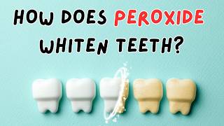 HOW DOES PEROXIDE ACTUALLY WHITEN YOUR TEETH [upl. by Kathy]