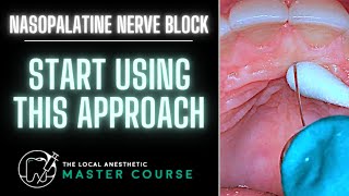 How to Do A Nasopalatine Nerve Block  Online Dental Continuing Education  LocalAnestheticcom [upl. by Eilssel]