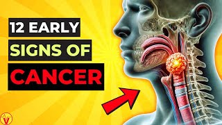 12 Warning Signs of CANCER Growing In Your Body You Shouldnt Ignore Never Miss  VisitJoy [upl. by Mosra]