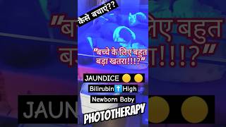 JAUNDICE🟡🟡PHOTOTHERAPY Newborn Baby Explained 👶👶Kitna Khatarnak jaundice newborn shorts [upl. by Nnylecoj]