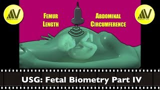 Fetal Biometry Part IV Femur Length amp Abdominal Circumference [upl. by Assital]