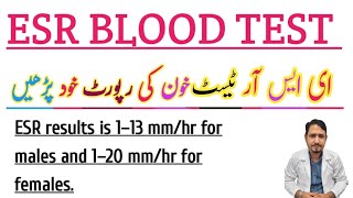 ESR BLOOD TEST Urdu Hindi Irfan Azeem [upl. by Jillie]