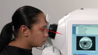 How do I acquire a highquality scan on my CIRRUS HDOCT Part 2 Fundus alignment [upl. by Normandy]