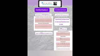 الفروقات مابين Cardioversion amp Defibrillation ببساطة انشروهاللاستفادة [upl. by Affrica]