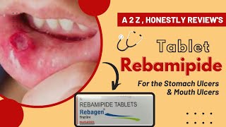 Rebamipide Tablets UsesReviews  Medicine For Stomach UlcersMouth Ulcer [upl. by Lledualc]