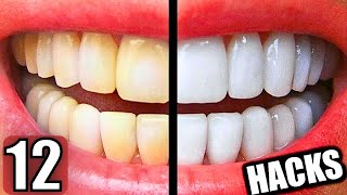 12 Easy Ways to Make Your Teeth Whiter at Home [upl. by Rdnaskela618]