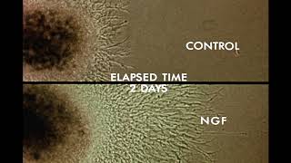 8 Response of Cells to Nerve Growth Factor NGF [upl. by Jamey]