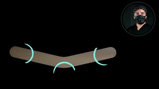 How to modify tofflemire matrices for dental composite veneers [upl. by Meesak]