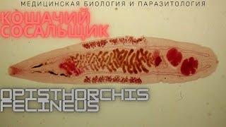 Кошачий сосальщик Opisthorchis felineus  Описторхоз Жизненный цикл Диагностика Профилактика [upl. by Alfy110]