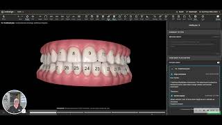 Tooth Numbering System So you can better communicate with your dentist or orthodontist [upl. by Malita703]