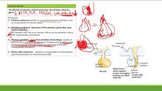 Hypopituitarism  Endocrine System  Step 1 Simplified [upl. by Fabron]