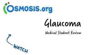 Glaucoma  Clinical Presentation [upl. by Procter]