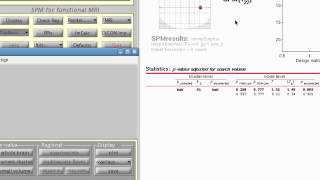 Quick and Efficient ROI Analysis in SPM Part 1 [upl. by Heinrike210]