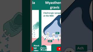 Myasthenia gravis  Pathology in 1 minutes  USMLE step 1 [upl. by Jaenicke]