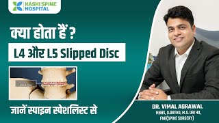 L4 and L5 slipped discs kise kahate hain । Dr Vimal Agrawal [upl. by Mae]