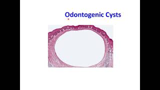 Odontogenic Cysts [upl. by Leelahk]