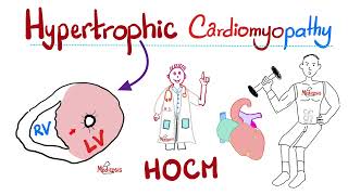 Hypertrophic Cardiomyopathy HOCM  Cardiology Series [upl. by Krystle438]