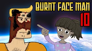 Burnt Face Man Episode 10 [upl. by Merchant]