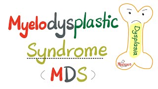 Myelodysplastic Syndrome MDS  a precursor to Acute Myeloid Leukemia AML   Hematology Series [upl. by Roban]