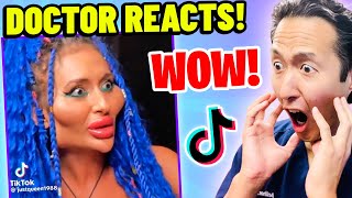 Plastic Surgeon Reacts to BOTCHED Plastic Surgery TikTok Videos [upl. by Elawalo]