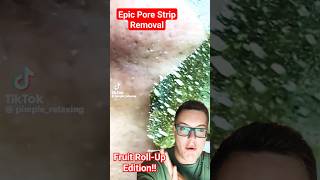 EPIC PORE STRIP REMOVAL  Fruit RollUp Blackhead Removal 😂 shorts [upl. by Witha]