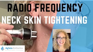 NECK RADIO FREQUENCY TREATMENT  SKIN TIGHTENING [upl. by Dalton]