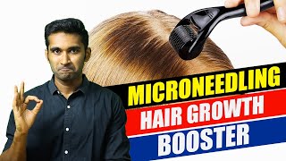 How to do MICRONEEDLING at home for HAIR GROWTHதமிழ் tamil haircare hairgrowth hairloss [upl. by Airbma]